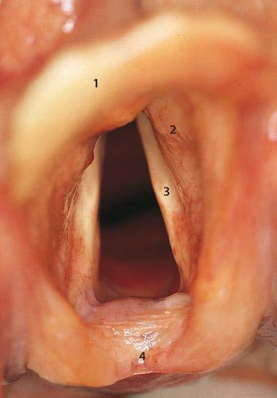 Glottis: vocal folds + space between them - The