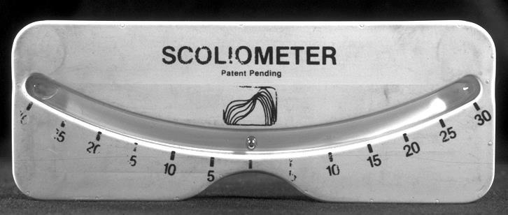 Scoliometer, Inclinometer Choose area of greatest asymmetry Center on the spinous processes