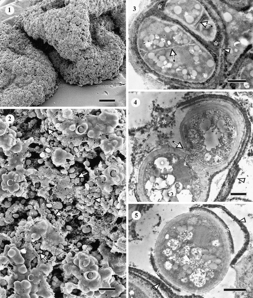 1138 MYCOLOGIA FIGS. 1 5. Phaeotheca fissurella. PDA, 3 wk, SEM (1, 2) and TEM (3 5). 1. Overall view of colonies. 2. Higher magnification of a colony surface.