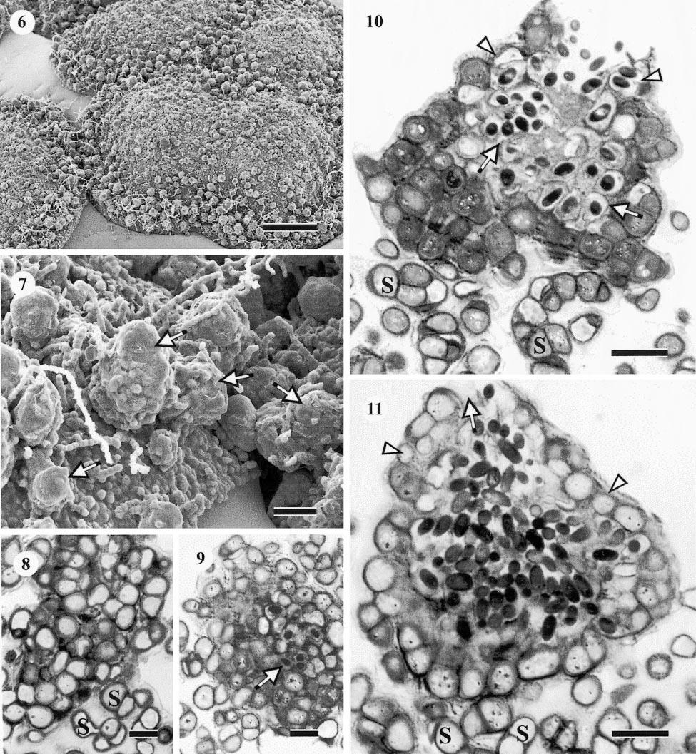 TSUNEDA ET AL: ENDOCONIDIOGENESIS 1139 FIGS. 6 11. Endoconidioma populi. CMAD, 2 mo, SEM (6, 7). LM (oil immersion) of thin sections (8 11). 6. Overall view of colonies. 7. Enlarged view of a part of FIG.