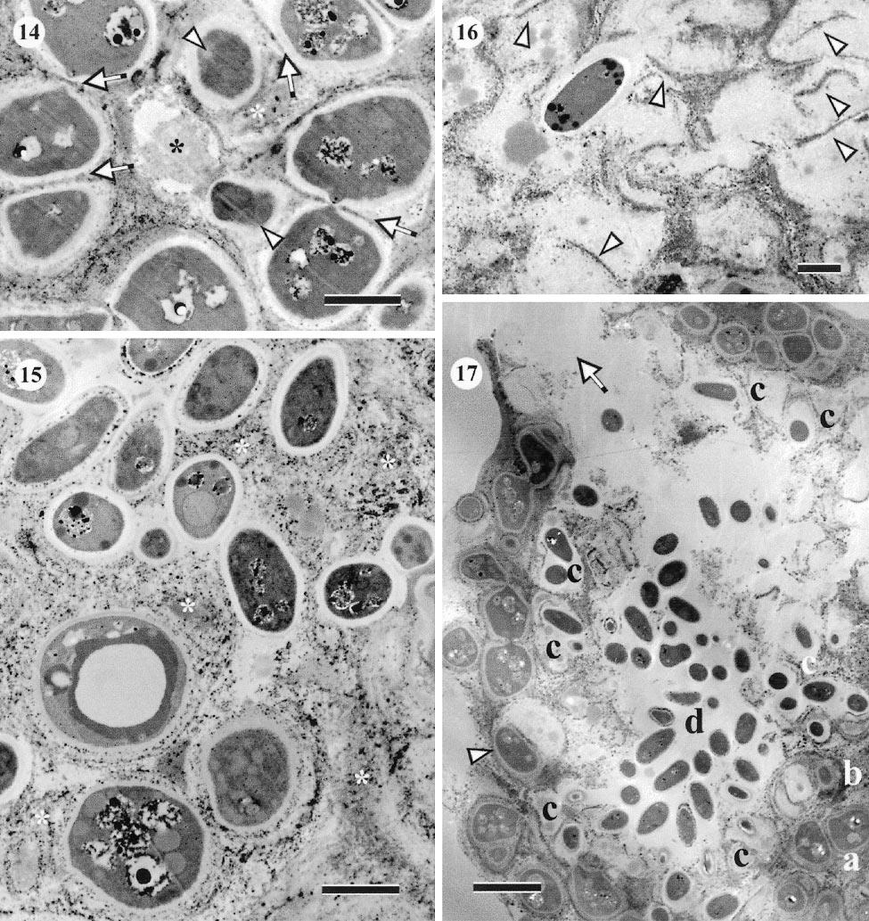TSUNEDA ET AL: ENDOCONIDIOGENESIS 1141 FIGS. 14 17. TEM of different stages of endoconidiogenesis in Endoconidioma populi. CMAD, 2 mo. 14. Actively dividing conidiogenous cells that were forming daughter cells.