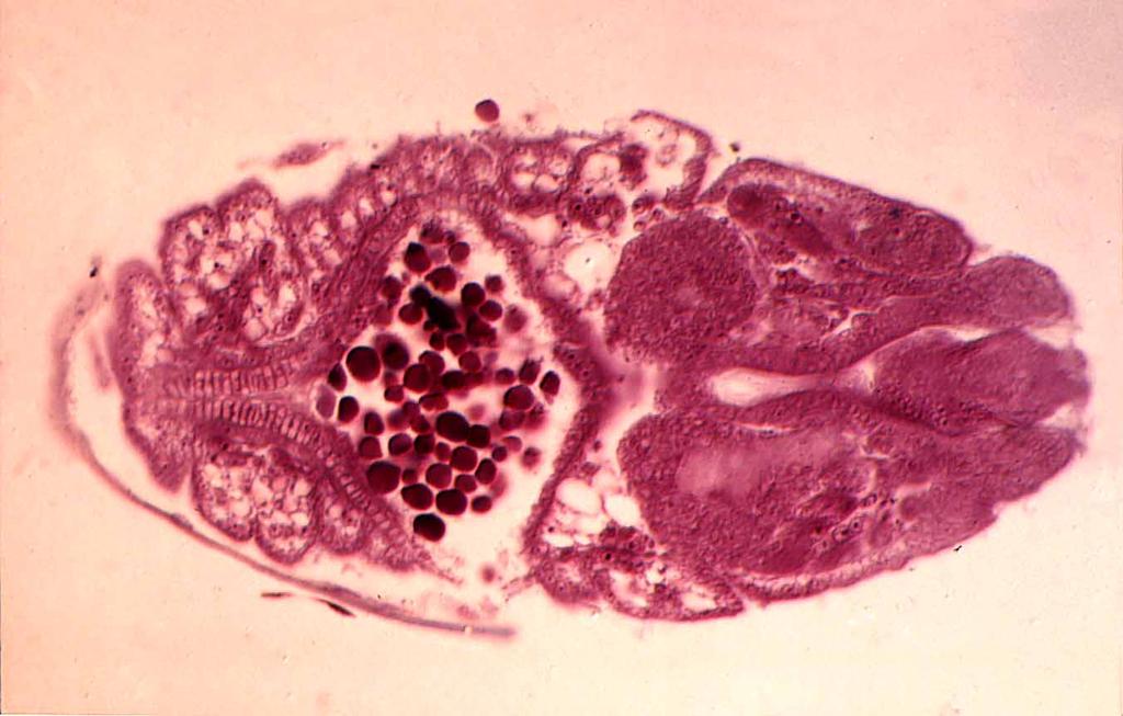 embryo of Lytta L.S.