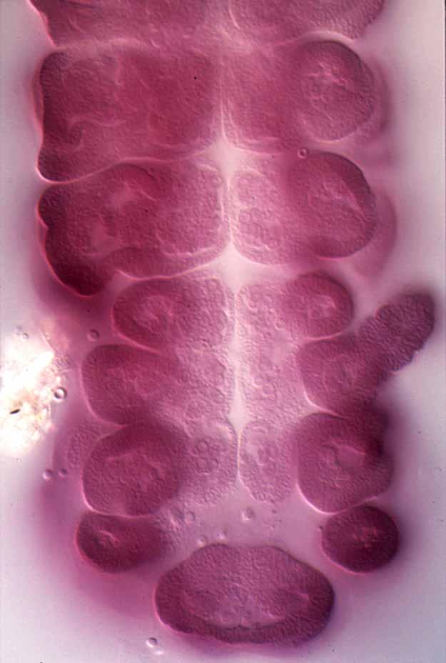 embryo of Lytta embryo of