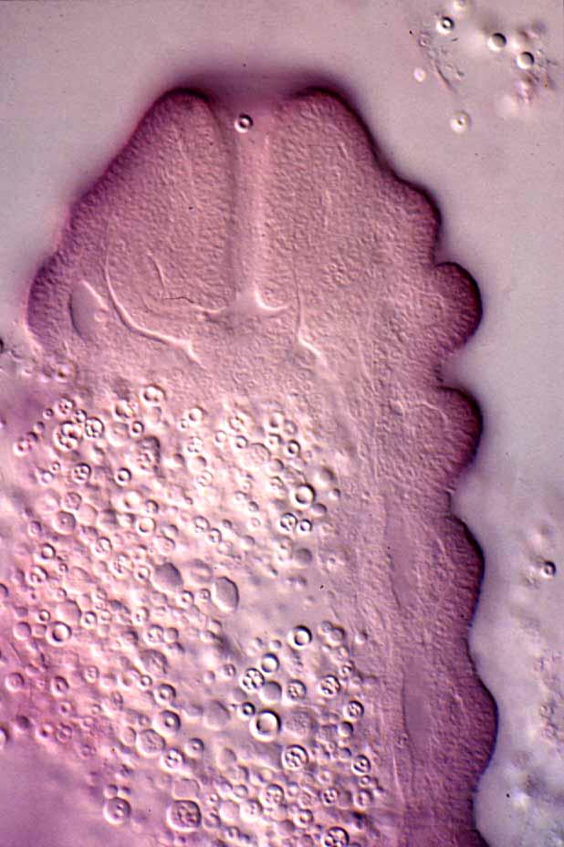 embryo of Lytta of 72h embryo