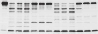 -/- hypotonicity hypotonicity F KCl Casp -/- IL-α p3 THC (µg ml - ) IL-α p8 IL-β p7 IL-α p8 IL-β p3 Caspase- p KCl Casp -/- IL-β p7 Sphingosine (µg ml - ) 3 3 3 Casp p46 IL-α p8 IL-β p7 Caspase- p