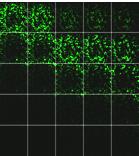 , Schematic of the dynamic in vitro invasion assay monitoring invasion of normal omental fibroblasts (s), adjacent