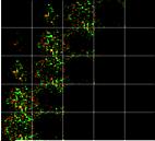 mirns regulate s Direction of invasion OvCa cells djacent