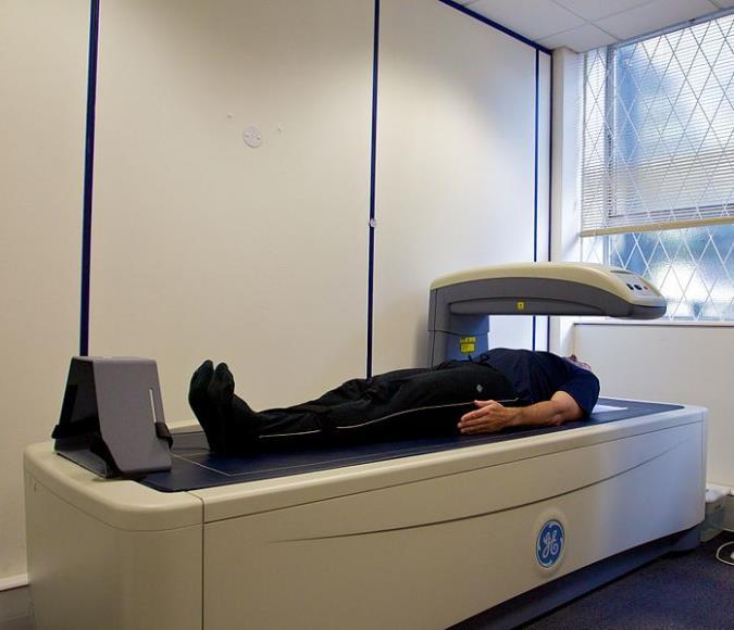 How is bone density measured? The most common test for measuring bone density is a DEXA scan. That stands for dual energy X-ray absorptiometry.