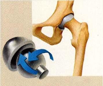 Ball and Socket- A ball and socket joint allows for radial movement in