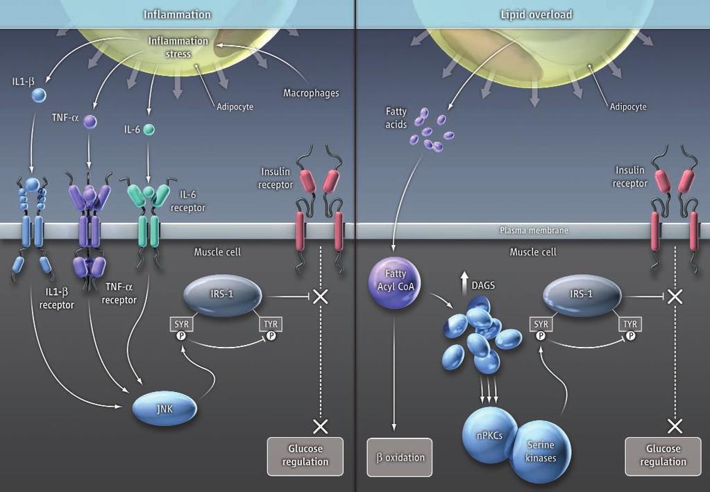 ILLUSTRATION: C. BICKEL/SCIENCE Main contenders. Two explanations for the mechanism of insulin resistance have emerged: inflammation (left) and lipid overload (right).