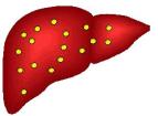 The Central Role of Fatty Liver in the Pathogenesis of Insulin Resistance in Obese Adolescents D`Adamo E et al, Diabetes Care 211?