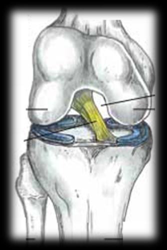 anteromedial band- tightest during knee