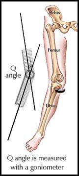 Structural Factors High Q-angle and increased pelvic width are often looked to for increased knee injury rates in females.
