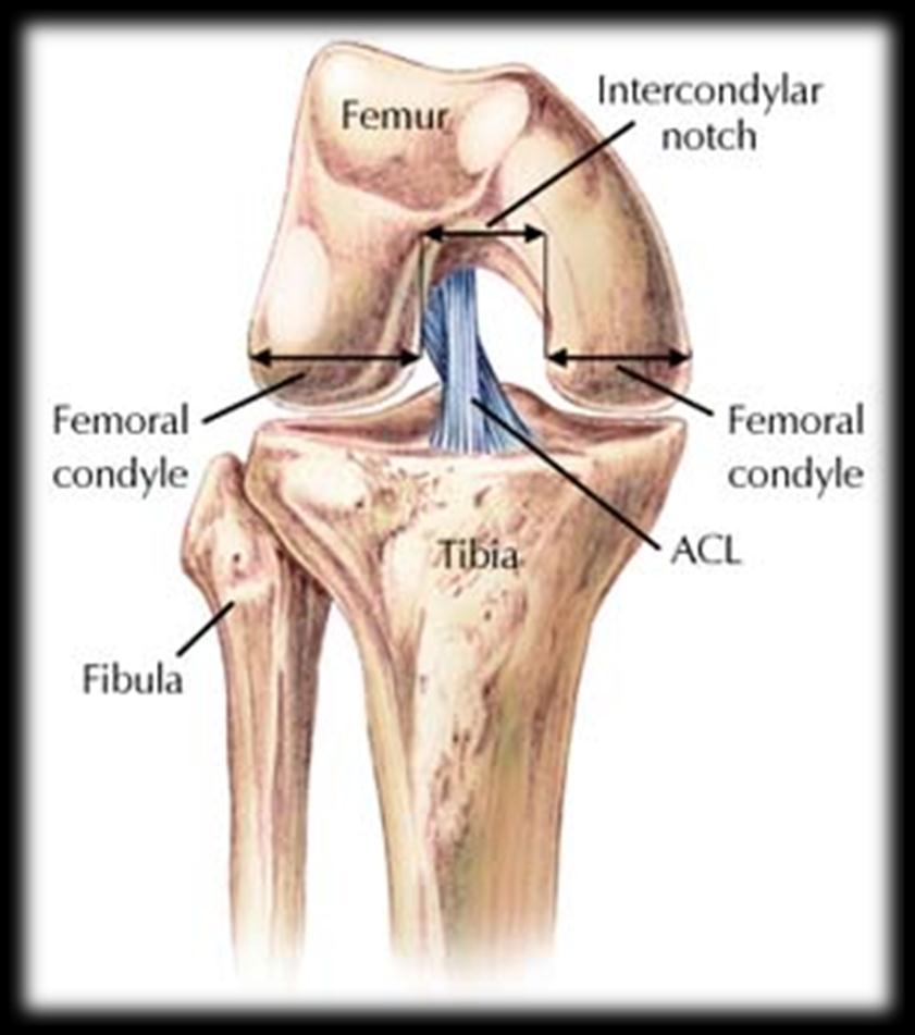 Femoral Intercondylar Notch The Femoral Intercondylar notch is the notch in front of the femur and the tibia.