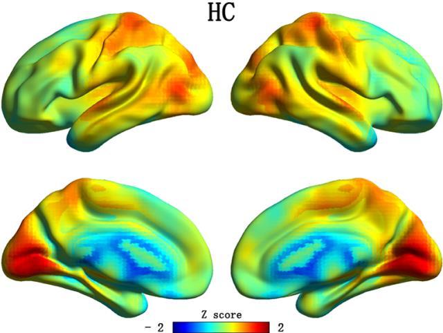 Yang et al. 0 Fig.S Fig.S Functional connectivity strength (FCS) maps.