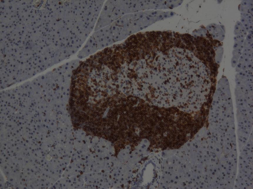 Figure 2. CD3 stained islet beta cells from the pancreata of diabetic mice.