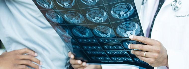 When to order imaging studies Neurological Risk factors for cerebrovascular disease.