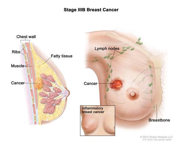 + Physiology q 3-10% of breast or ovarian cancers are considered to be HBOC (occurrences estimated to be 1:300 to 1:800) q Target tissues include: q Breast and ovaries in women q Breast and