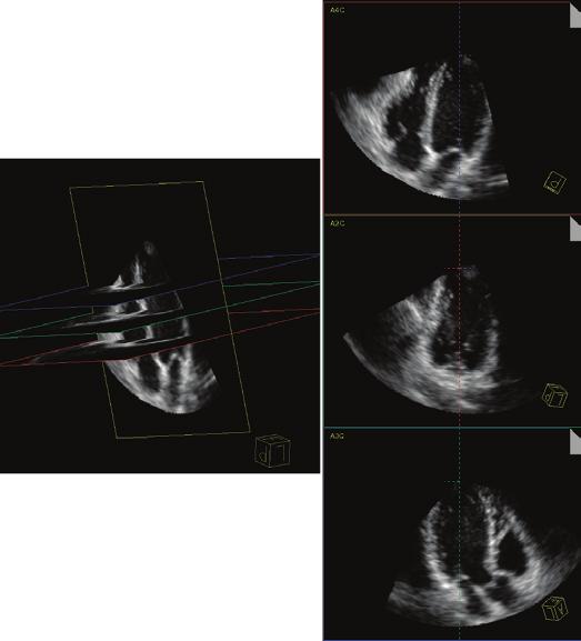 conventional two-dimensional echocardiography.