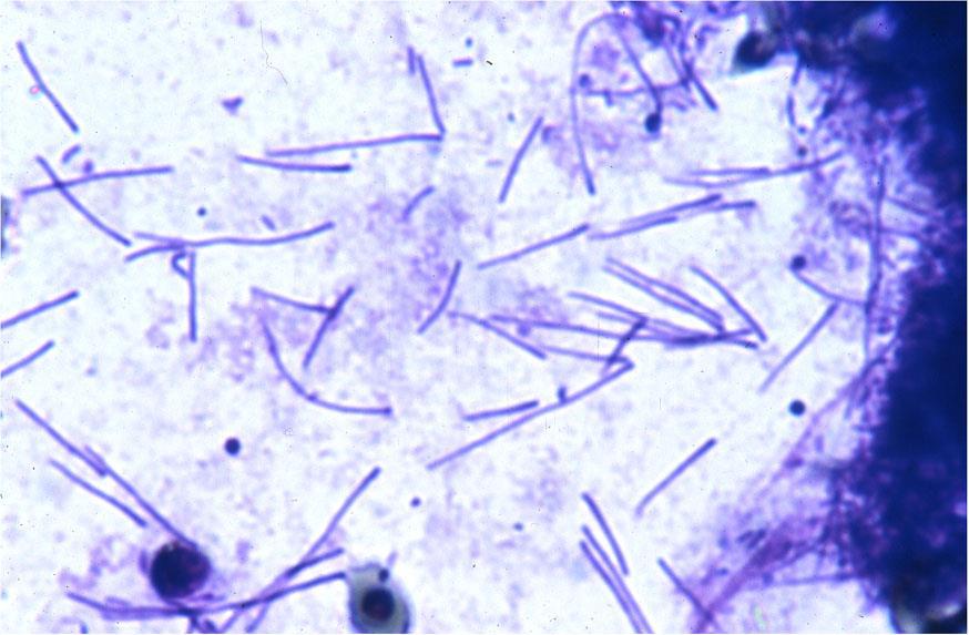 Tenacibaculum maritimum - Fastidious filamentous (5-40 mm ) gliding bacterium.