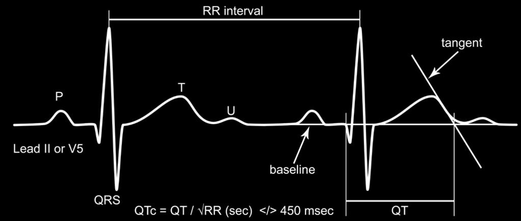 How to accurately assess the QT interval fields of internal medicine except cardiology).