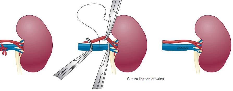 Vascular injuries.