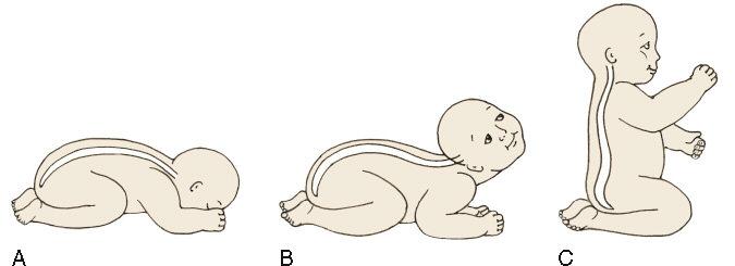 Development of the Spinal Curves: - Born with one kyphotic