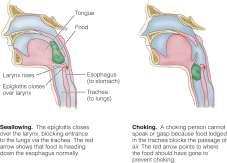 Choking Highlight 3 Common Digestive Problems Food slips into