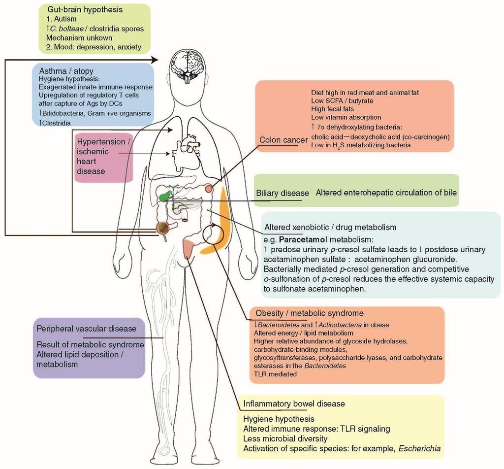 Diseases Directly Influenced by te Gut Microbiome Source: