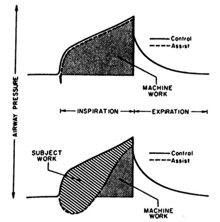Marini ARRD 1986;134:902 Inspiratory Time In spontaneous breathing patients,