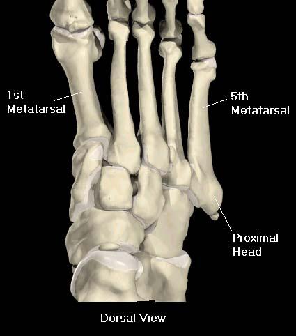 Metatarsals 5 Bones 1 st metatarsal is the largest and strongest and functions as the main body