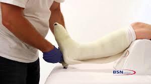 By definition, a Total Contact Cast is rigid and is the 'Gold Standard' in the management/healing of DFUs. It incorporates all components necessary for providing a truly rigid casting.