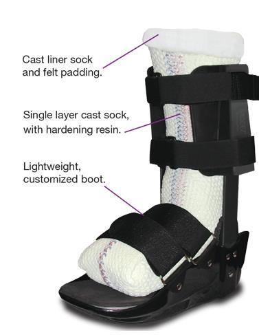 TCC-EZ TCC-EZ is a unique and versatile total contact cast system designed to reduce application time while providing improved healing rates for the diabetic foot ulcer and increased stability and