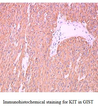 KIT ( c-kit or CD117 ) KIT is a specific protein; it is made by only a few types of adult cells, including ICCs and GISTs.