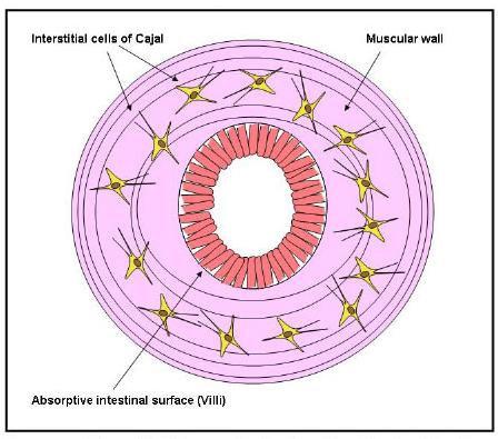 ICCs: the cells where GISTs start; Interstitial cells of