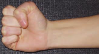 3. Make a fist and then straighten the fingers. Wrist Do the exercises as advised by your therapist. With your fingers bent slowly move your wrist forwards and backwards.