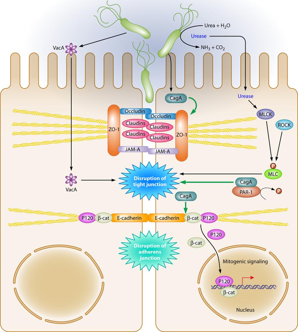 VOL. 23, 2010 H. PYLORI AND GASTRIC CANCER 727 junctions (269) (Fig. 5).