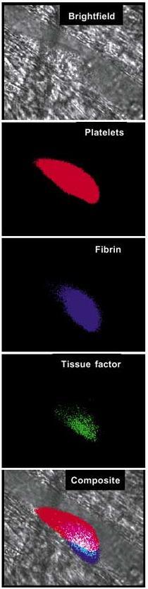 In vivo arterial thrombosis involves platelet aggregation, tissue factor generation and fibrin