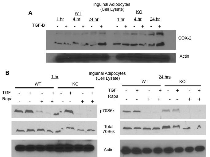 Figure 2. A, the mrna expression of TGF- β in WT and Lcn2 KO adipocytes when treated with rapamycin for 20 hours. Results indicate mean ± SE. #, p < 0.05 from WT control; *, p < 0.05, WT vs. Lcn2 KO. B, p70s6k protein expression in WT and Lcn2 KO adipocytes when treated with TGF- β for 15,30, 60 minutes.