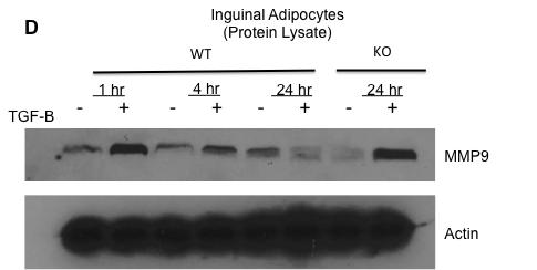 Figure 5. A-C, the mrna expression of Col3A1 (A), MMP9 (B), Col1A1 (C) in WT and Lcn2 KO adipocytes when treated with TGF- β, rapamycin, or TGF- β and rapamycin for 20 hours.