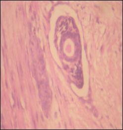 LYMPHATIC C HANNEL LINED BY FLATTENED ENDOTHELIAL