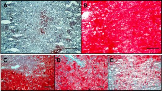 Supplemental Figures S-Fig. 1 Accumulation of lipids in hepatocytes by ORO staining (A) Liver from ORX normal diet control group.