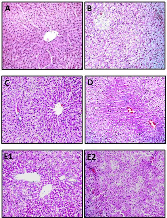 S-Fig. 2 Histopathology of the liver tissues by hematoxylin and eosin (H/E) staining from WT gonad intact (non-orx) SD male rats (n=6/group) (A) Liver from the WT normal diet (ND) control group.