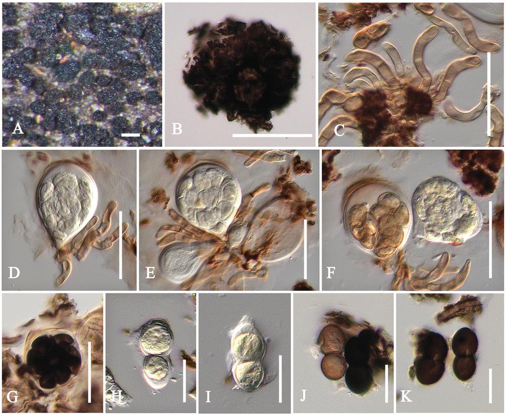 FIGURE 3. Parenglerula macowaniana (syntype). A. Black ascomata on host surface. B. Squash of ascoma. C. Brown to light brown pseudoparaphyses. D G. Asci containing ascospores. H, I.