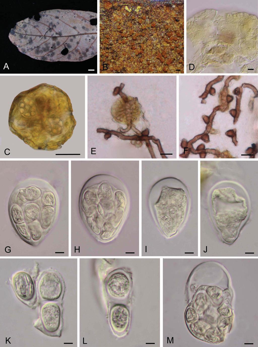 FIGURE 4. Rhytidenglerula carnea (holotype) A. Colonies on lower surface of leaf. B. Ascomata on mycelium. C. Ascoma containing asci. D. Squash of ascoma. E. Young ascoma on hyphae. F.