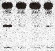 Enzyme assay carried out with FACL19 mutant proteins, FACL19L172Q (lane1 and 2), FACL9G179R (lane 3 and 4) and FACL19K192A (lane 5 and 6) in the absence or presence of 1mM CoAS respectively and the