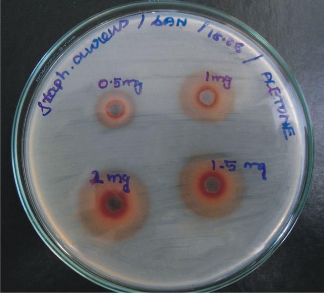 In vitro studies on Antibacterial activities of Terminalia arjuna (roxb.