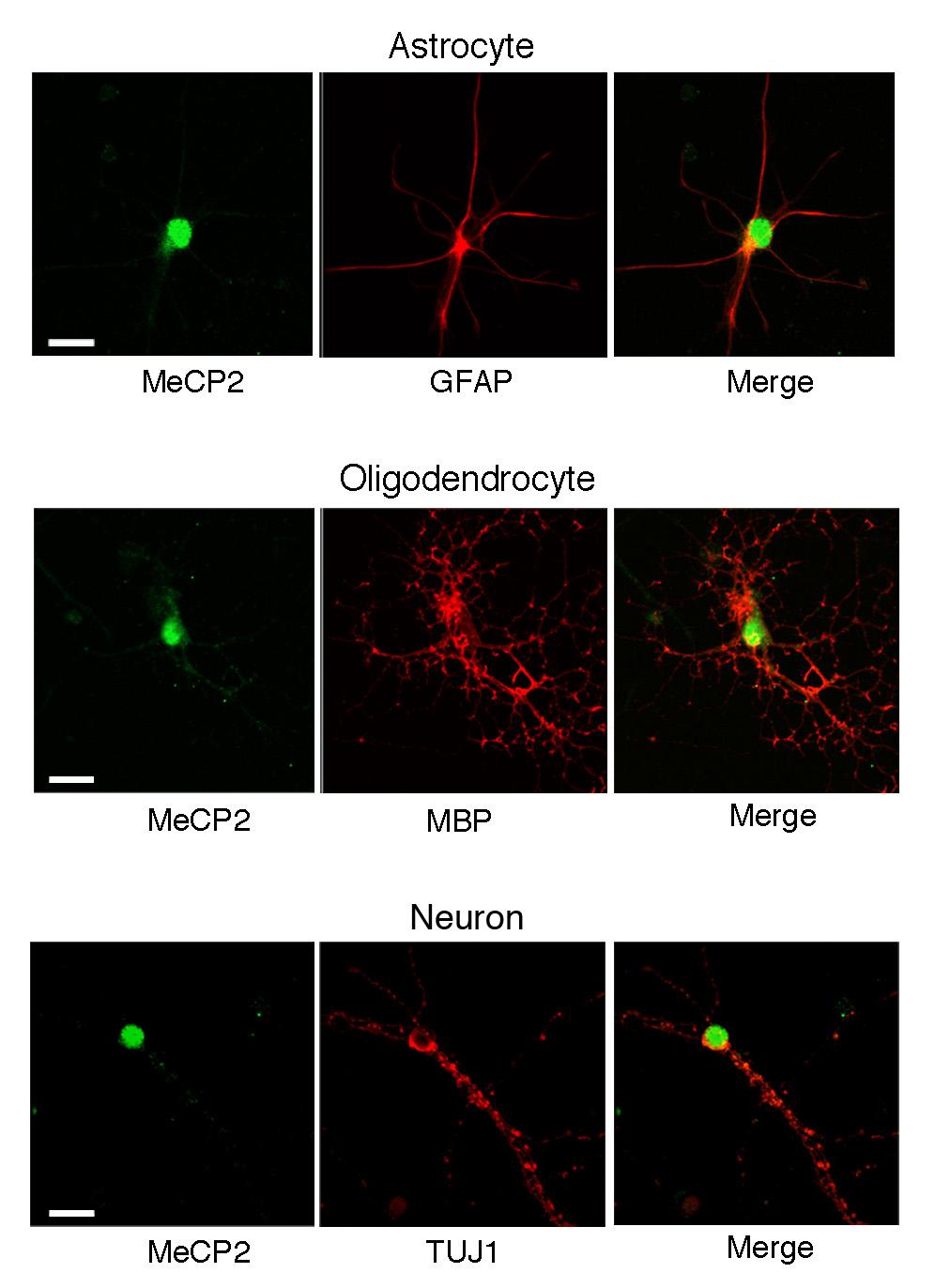 Supplementary Figure S2. MeCP2 protein is present in nuclei of glia in primary cerebellar cultures.