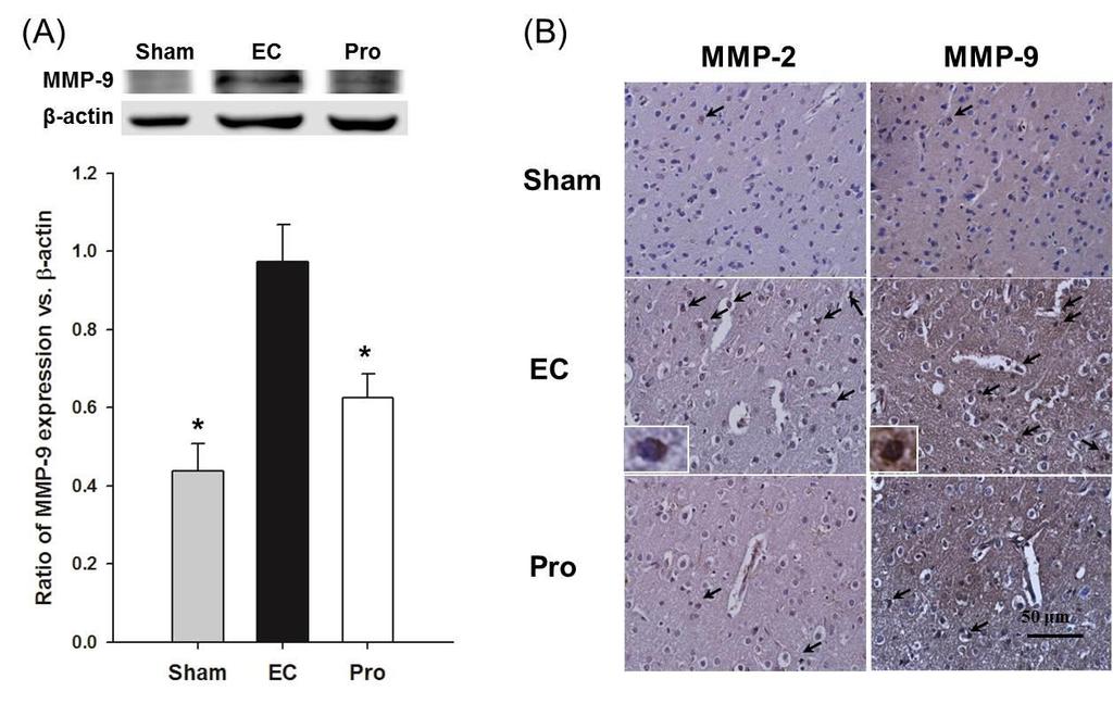 Figure 6. Post-treatment with propofol down-regulates the expression of MMP-2 and MMP-9 after ischemia-reperfusion. The expression of MMP-9 was assessed by immunoblotting.