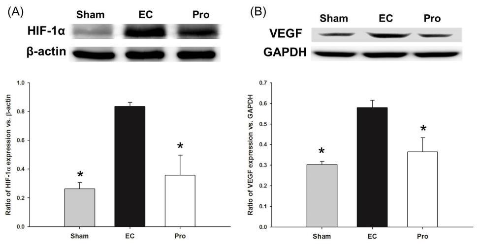 Figure 7. Effect of post-treatment with propofol on the expression of HIF-1α and VEGF after ischemia-reperfusion. The expression of HIF-1α and VEGF was assessed by immunoblotting.